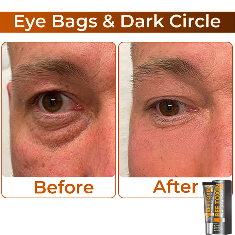 🎩 LOVILDS™ Collagen+ Bee Toxin Wake Up Eye Cream for MEN 🇺🇸 Dermatologist Recommended