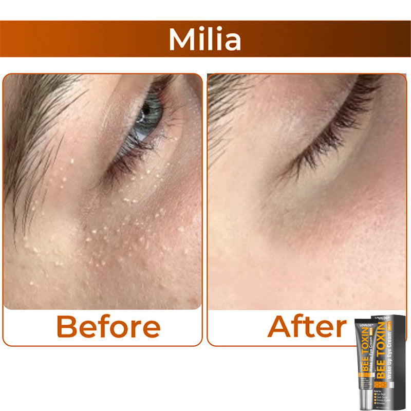 🎩 LOVILDS™ Collagen+ Bee Toxin Wake Up Eye Cream for MEN 🇺🇸 Dermatologist Recommended