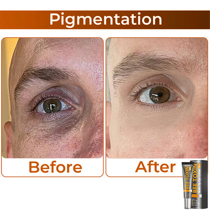 🎩 LOVILDS™ Collagen+ Bee Toxin Wake Up Eye Cream for MEN 🇺🇸 Dermatologist Recommended
